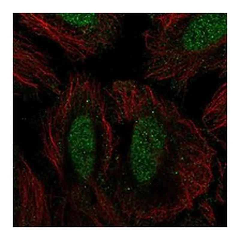 Atlas Antibodies Anti-SIK1 Antibody