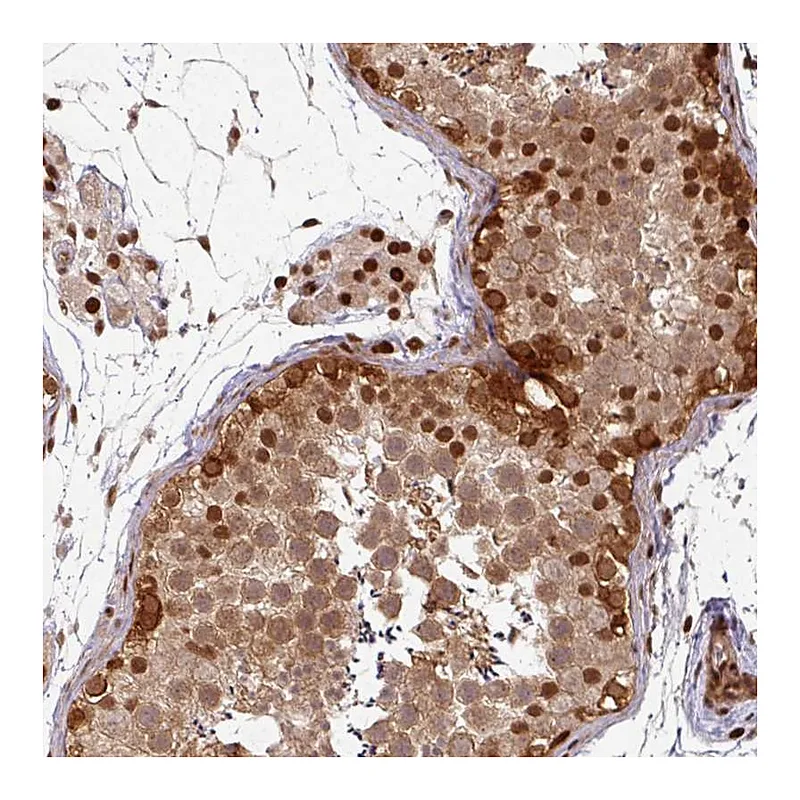 Atlas Antibodies Anti-SIK3 Antibody