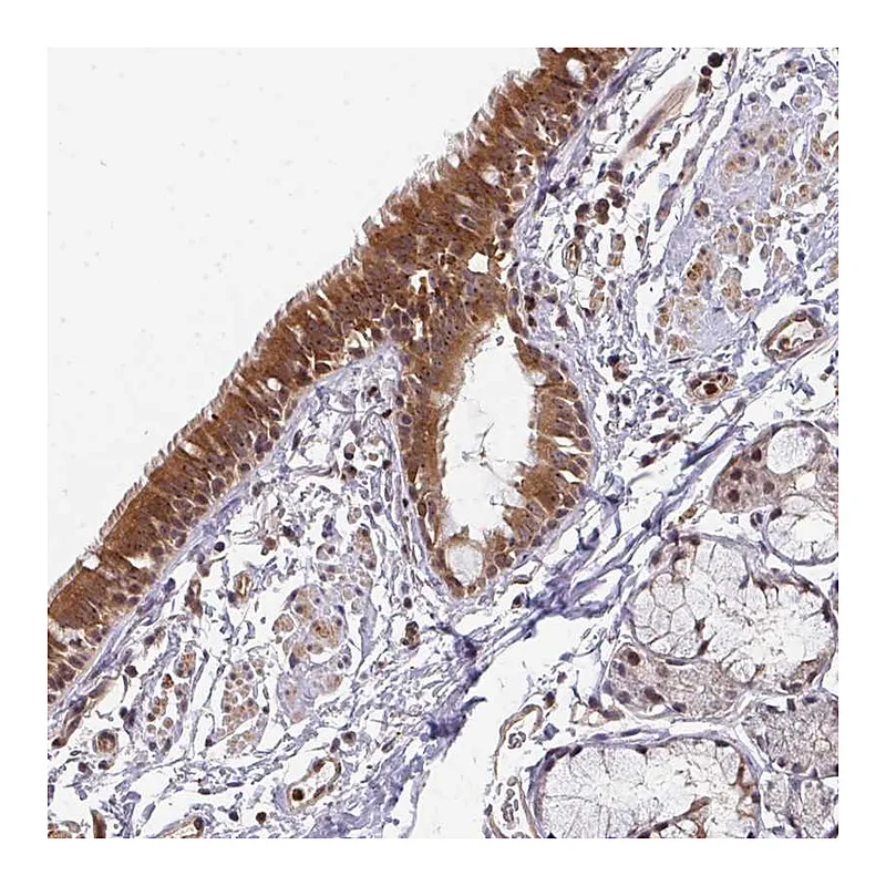 Atlas Antibodies Anti-SIMC1 Antibody
