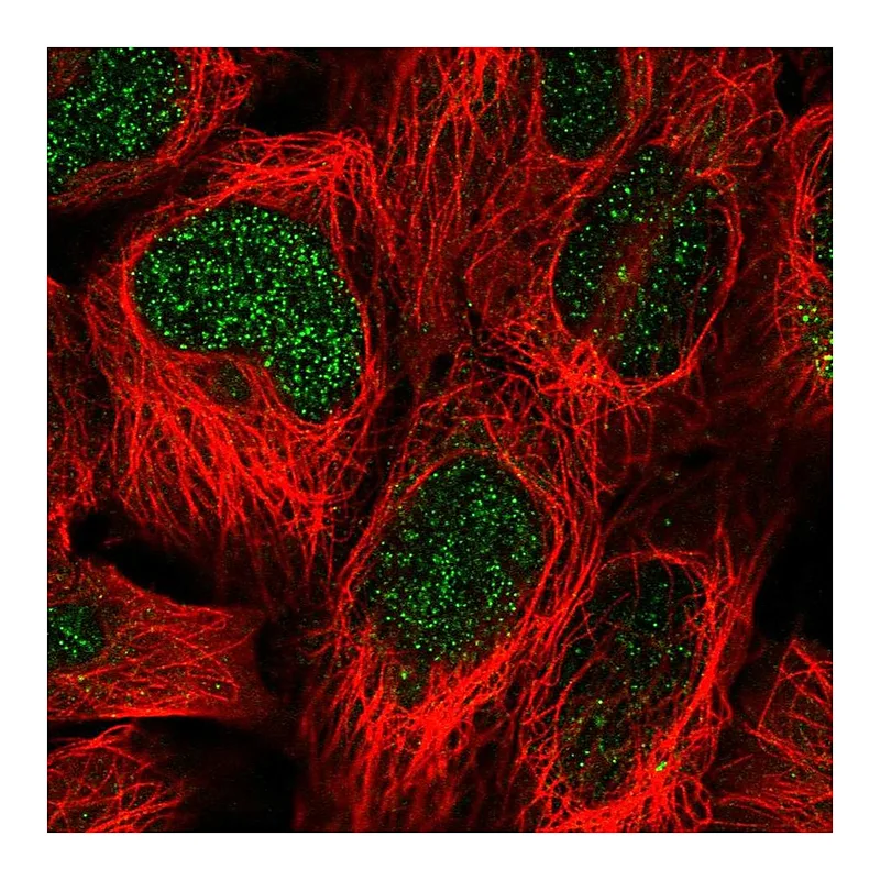 Atlas Antibodies Anti-SIMC1 Antibody