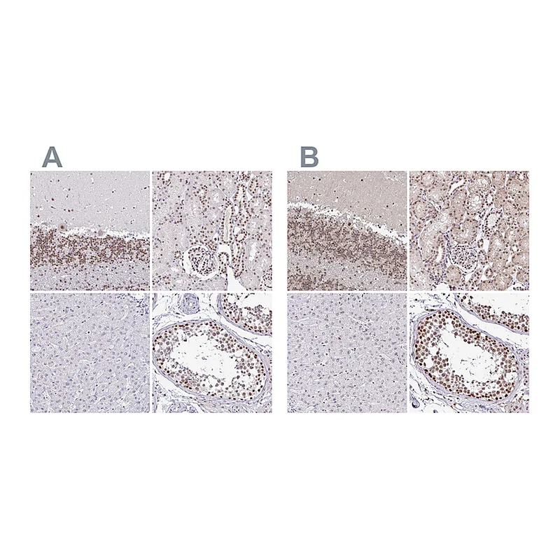 Atlas Antibodies Anti-SIN3A Antibody