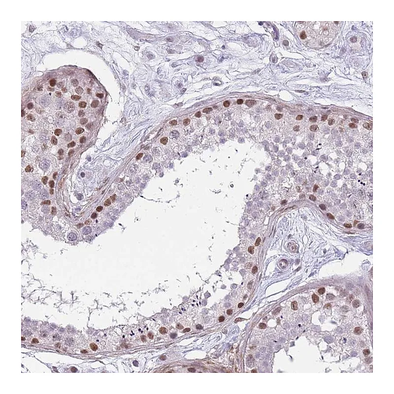 Atlas Antibodies Anti-SIN3B Antibody