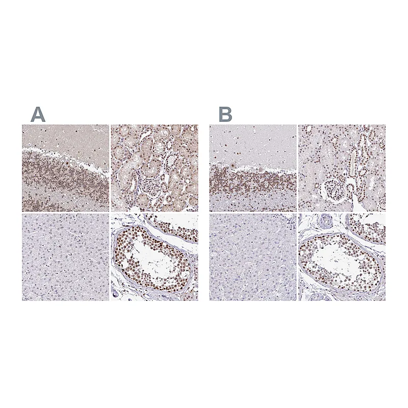 Atlas Antibodies Anti-SIN3A Antibody