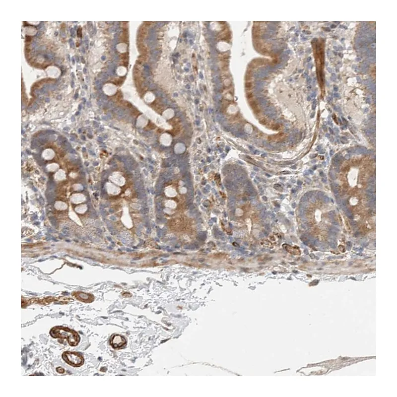 Atlas Antibodies Anti-SIPA1L2 Antibody