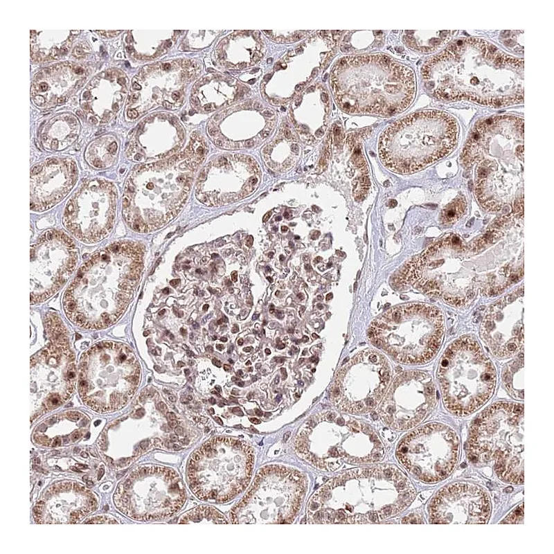 Atlas Antibodies Anti-SIPA1L3 Antibody