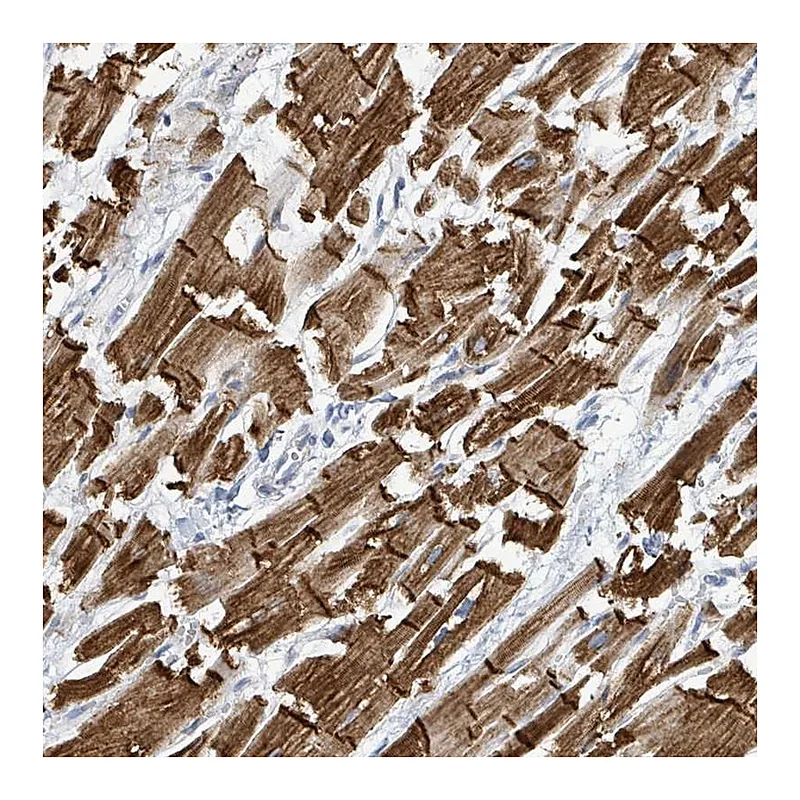 Atlas Antibodies Anti-SIRPB1 Antibody