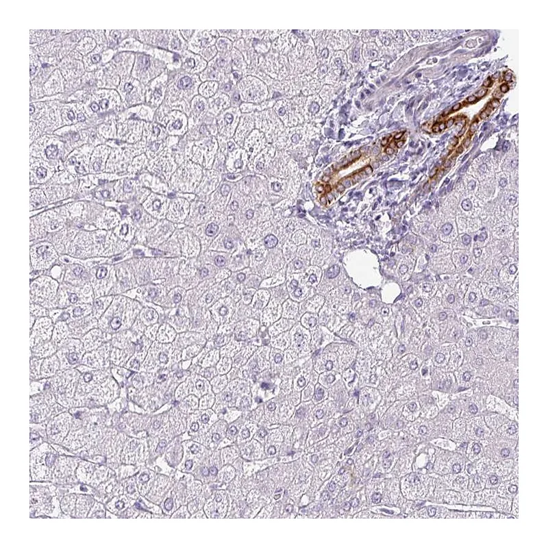 Atlas Antibodies Anti-SIRPB2 Antibody