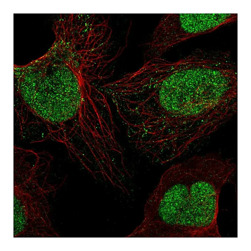 Atlas Antibodies Anti-SIRT1 Antibody