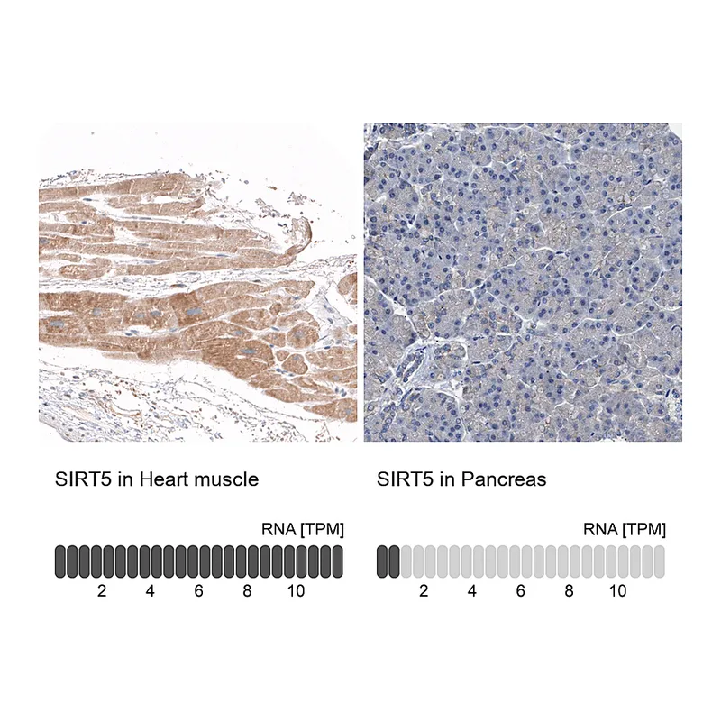 Atlas Antibodies Anti-SIRT5 Antibody