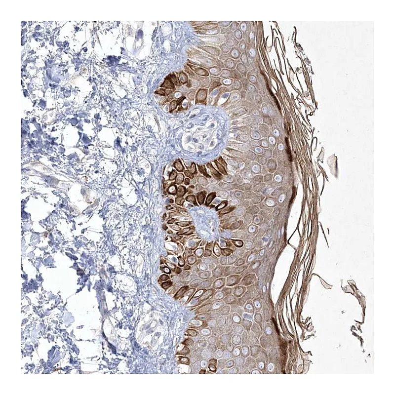 Atlas Antibodies Anti-SIRT3 Antibody