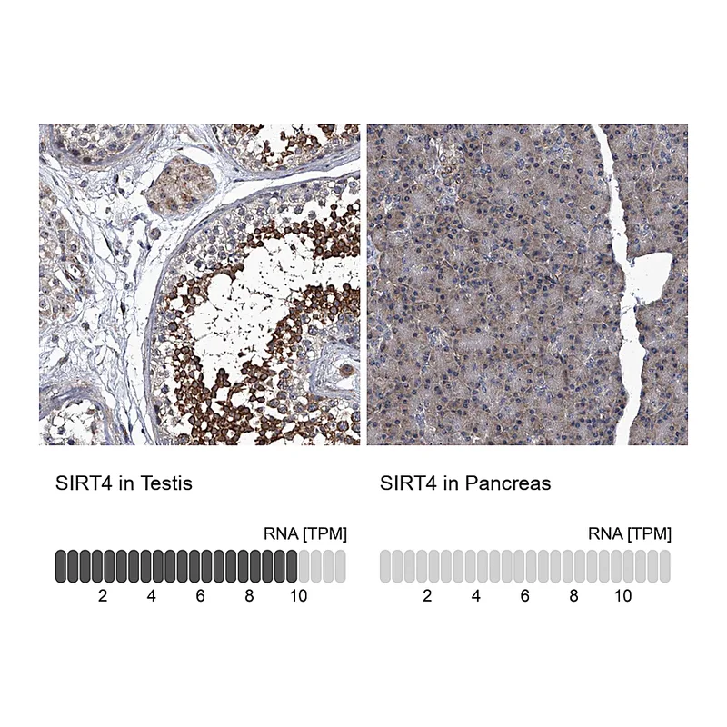 Atlas Antibodies Anti-SIRT4 Antibody