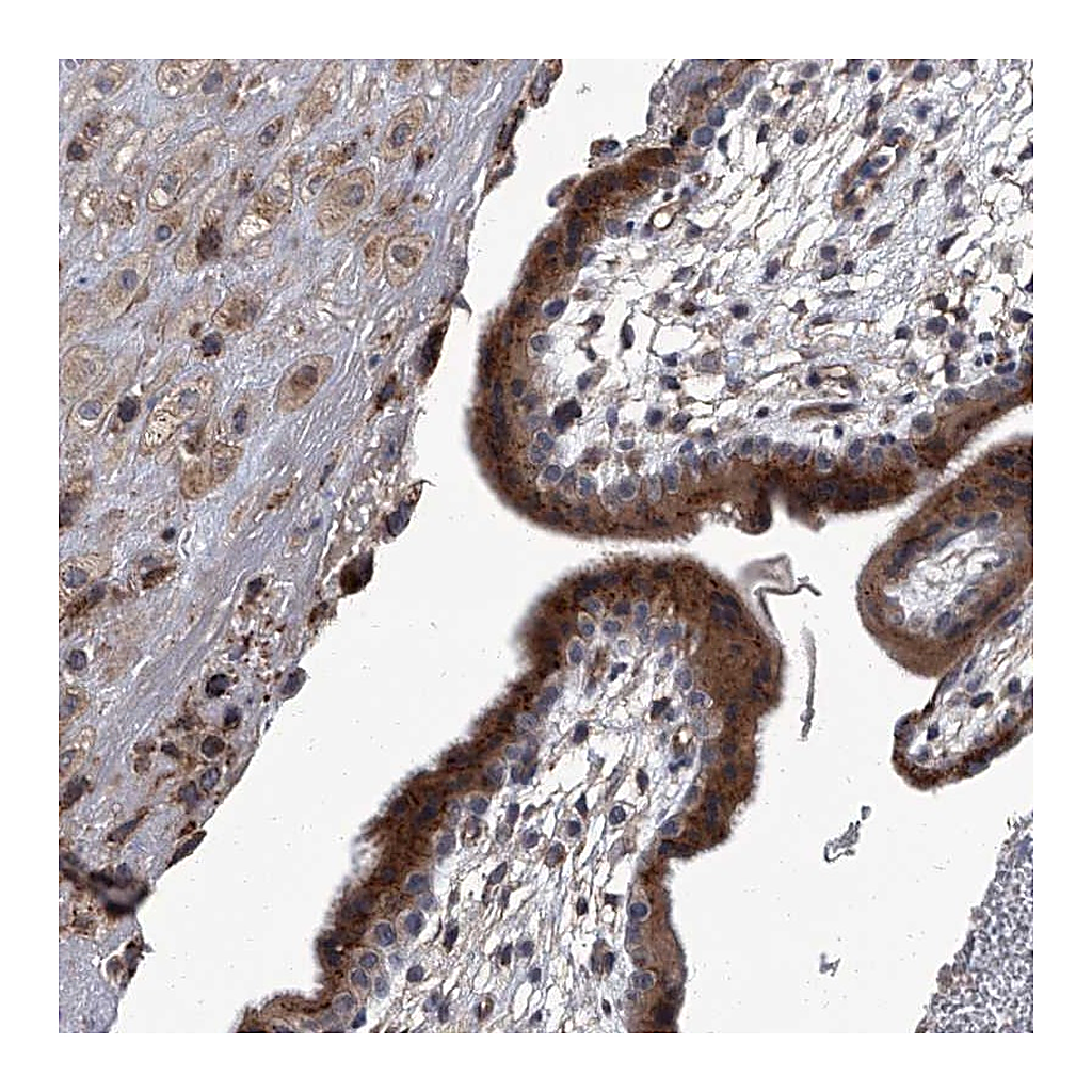 Atlas Antibodies Anti-SIRT4 Antibody