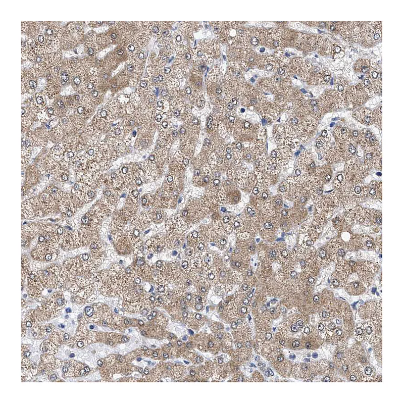 Atlas Antibodies Anti-SIRT5 Antibody