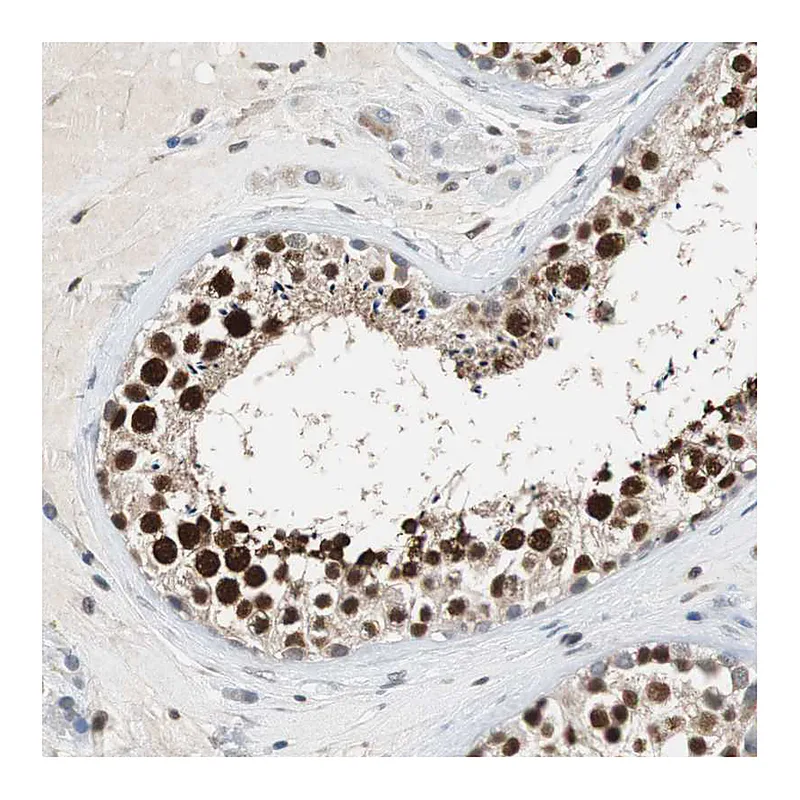 Atlas Antibodies Anti-SIRT1 Antibody