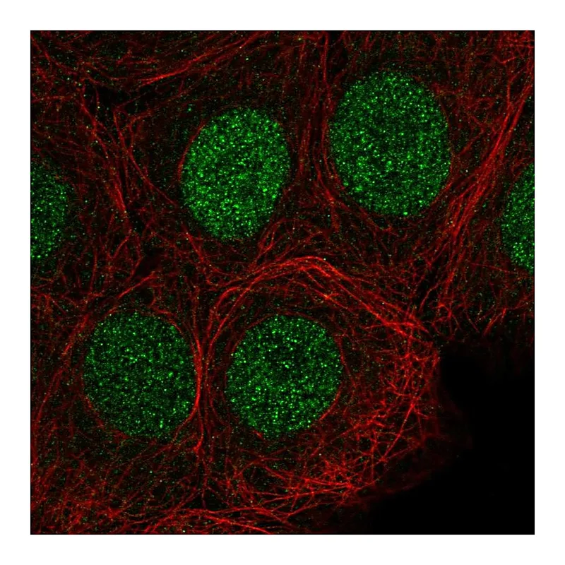 Atlas Antibodies Anti-SIRT6 Antibody