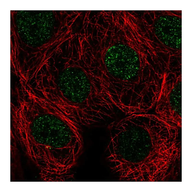 Atlas Antibodies Anti-SIVA1 Antibody