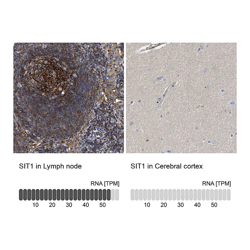 Atlas Antibodies Anti-SIT1 Antibody