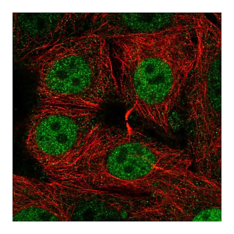 Atlas Antibodies Anti-SIVA1 Antibody