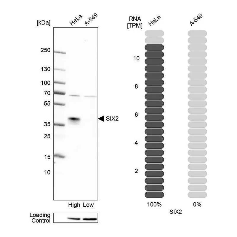 Atlas Antibodies Anti-SIX2 Antibody