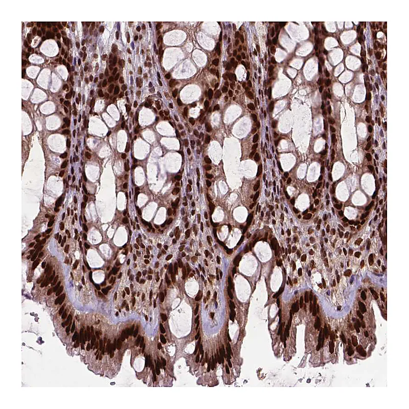 Atlas Antibodies Anti-SIRT6 Antibody