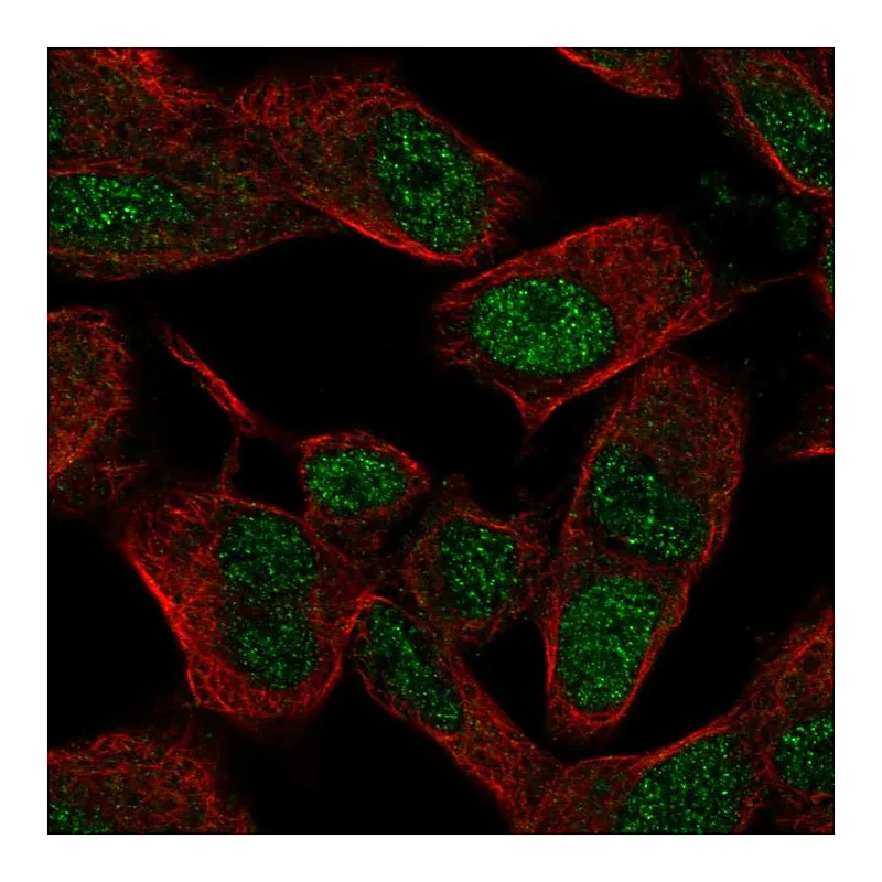 Atlas Antibodies Anti-SIX3 Antibody