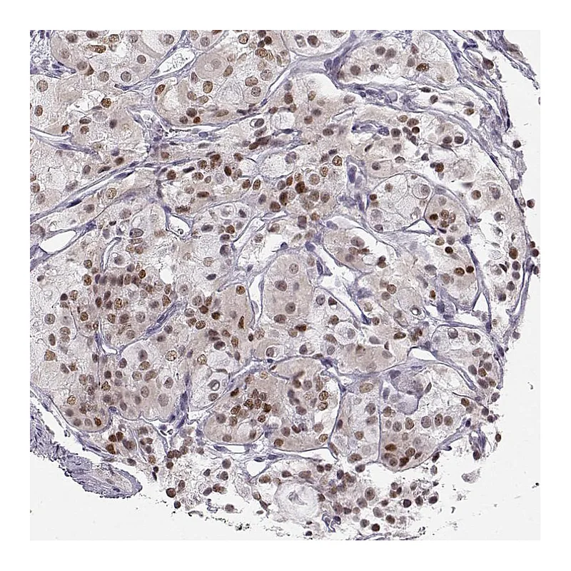 Atlas Antibodies Anti-SIX6 Antibody