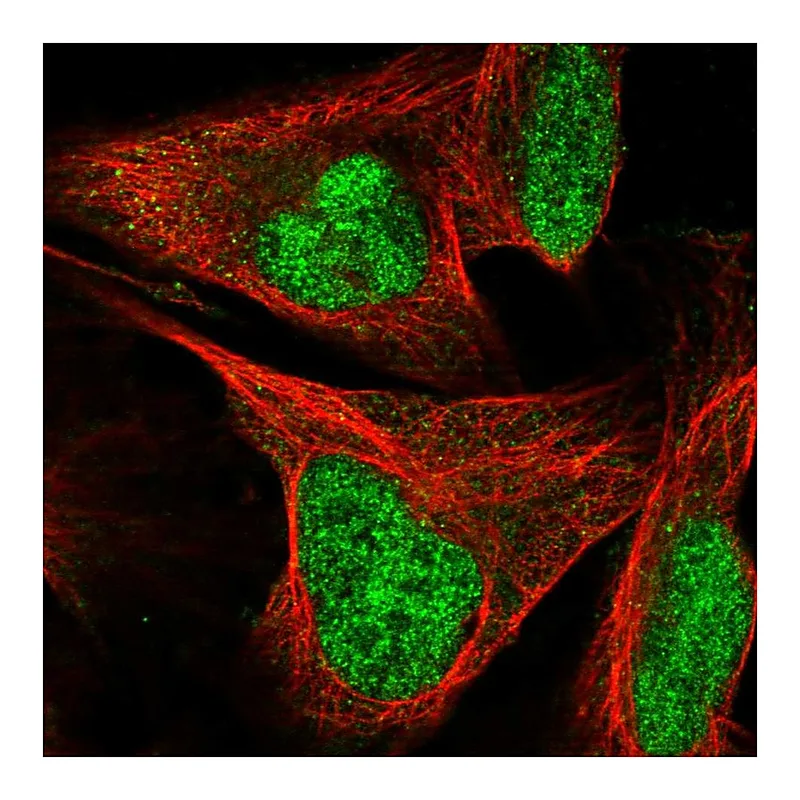 Atlas Antibodies Anti-SIX4 Antibody