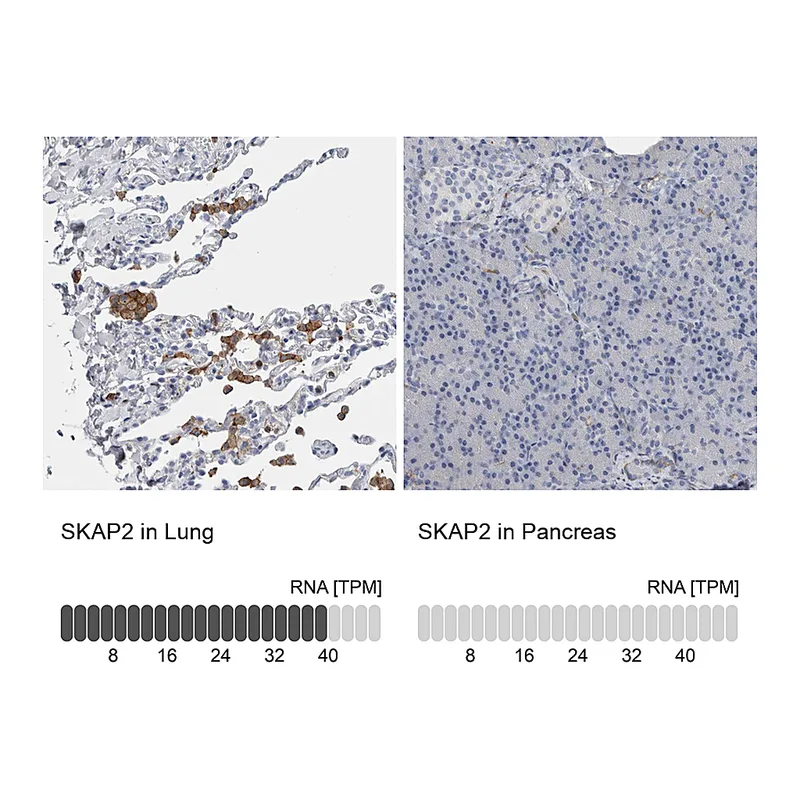Atlas Antibodies Anti-SKAP2 Antibody