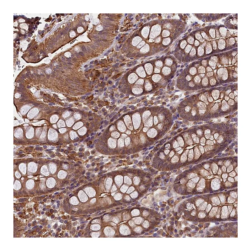 Atlas Antibodies Anti-SKIDA1 Antibody
