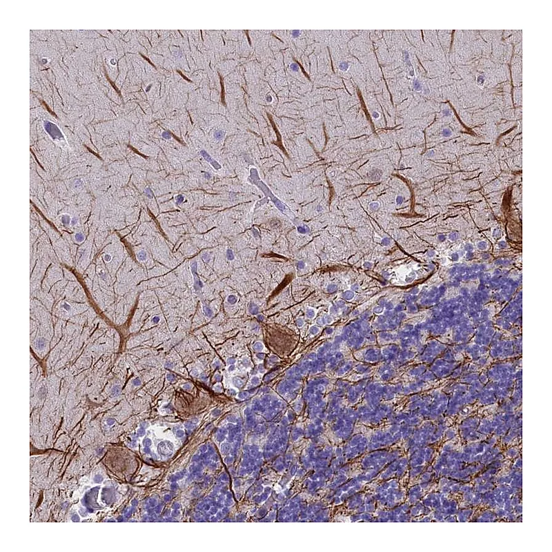 Atlas Antibodies Anti-SKIDA1 Antibody