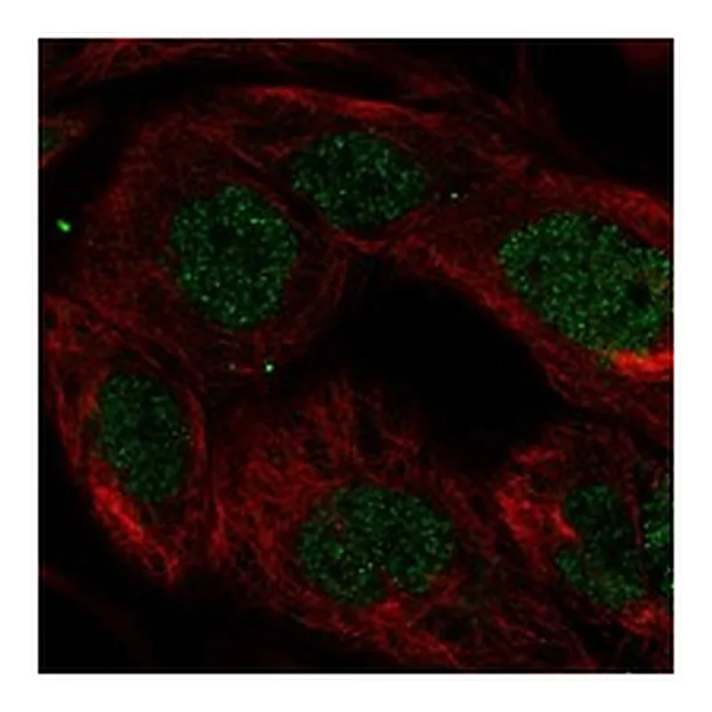 Atlas Antibodies Anti-SKIL Antibody