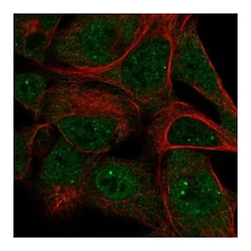 Atlas Antibodies Anti-SKIV2L Antibody