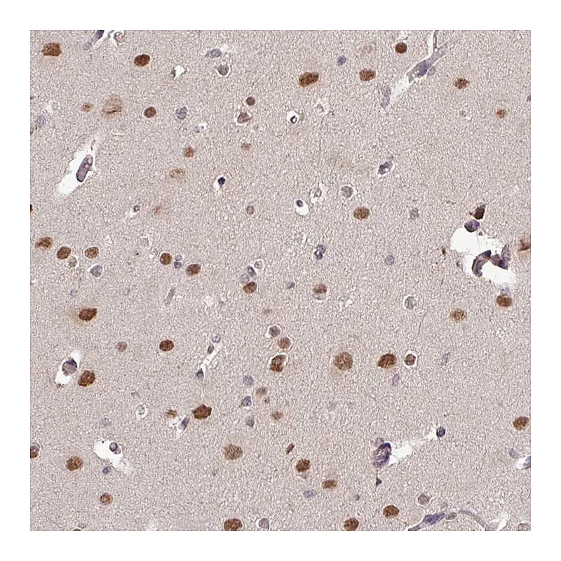 Atlas Antibodies Anti-SKIV2L Antibody