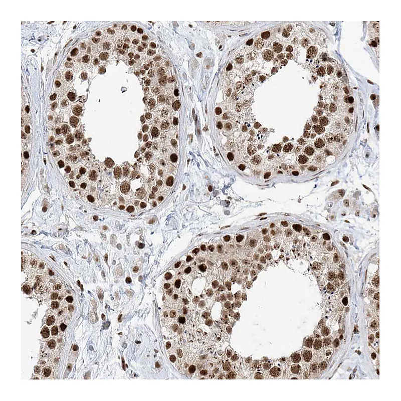 Atlas Antibodies Anti-SKIV2L2 Antibody