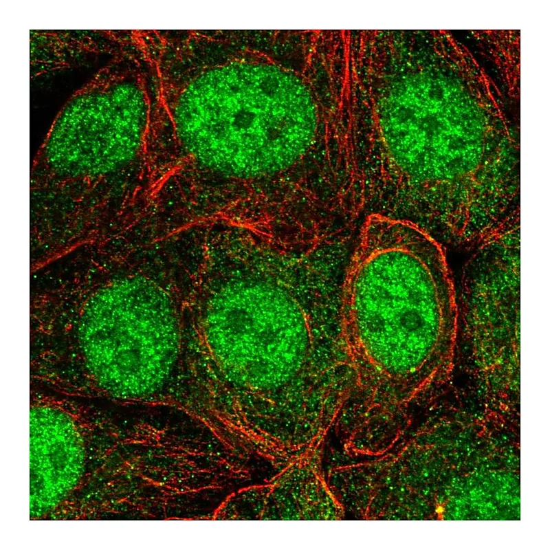 Atlas Antibodies Anti-SKP1 Antibody