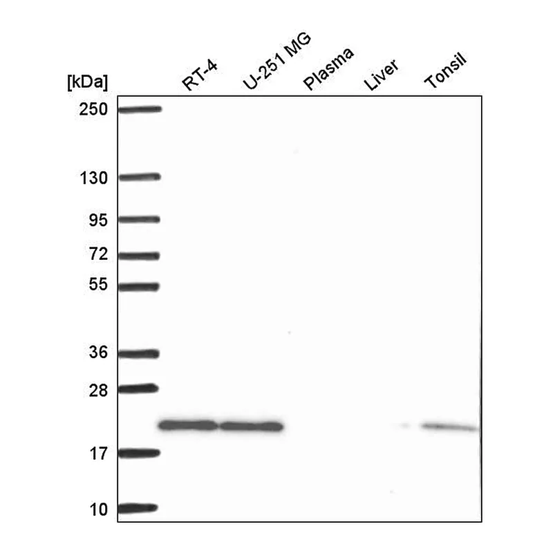 Atlas Antibodies Anti-SKP1 Antibody