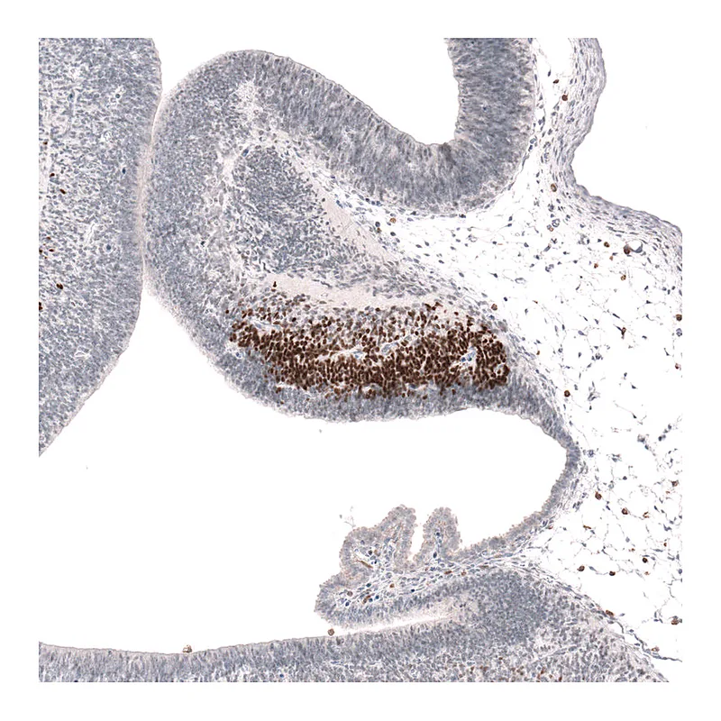 Atlas Antibodies Anti-SKOR2 Antibody