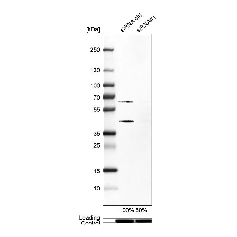 Atlas Antibodies Anti-SKP2 Antibody