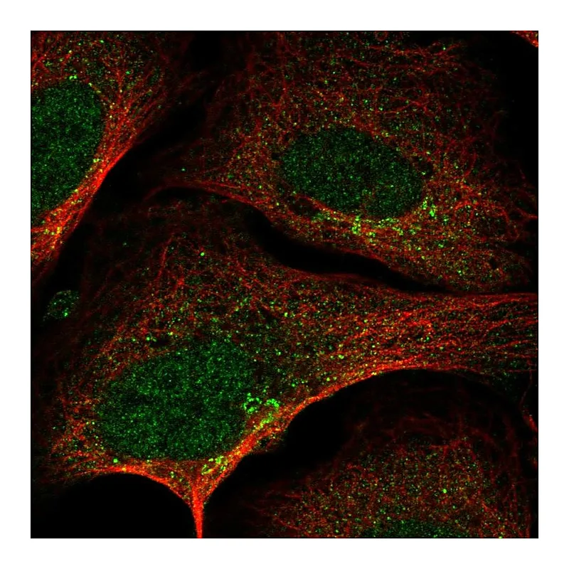 Atlas Antibodies Anti-SLA2 Antibody