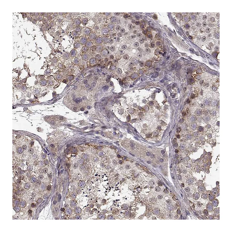 Atlas Antibodies Anti-SLAIN2 Antibody