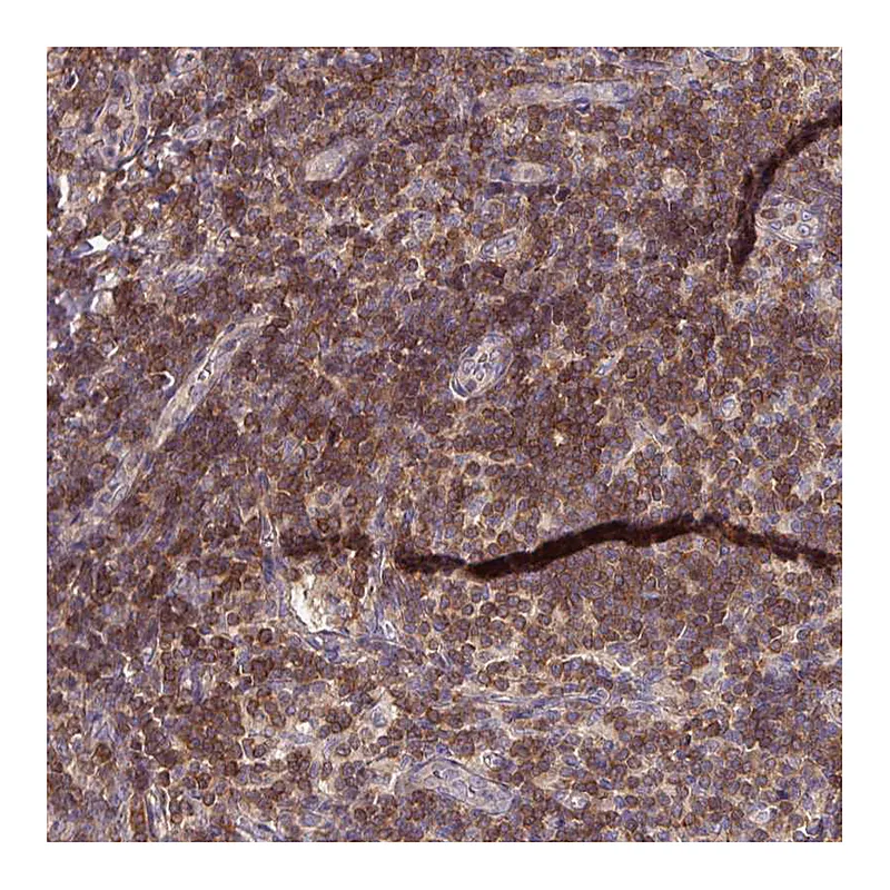 Atlas Antibodies Anti-SLAMF6 Antibody