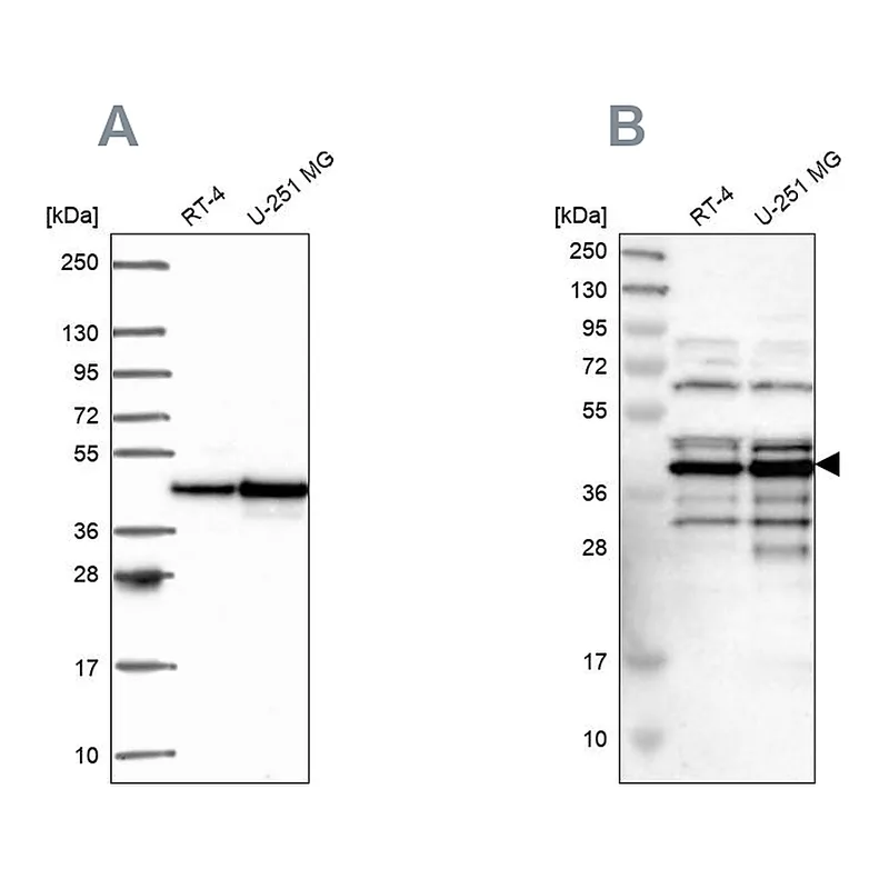 Atlas Antibodies Anti-SLBP Antibody