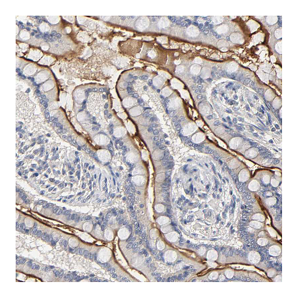 Atlas Antibodies Anti-SLC10A2 Antibody