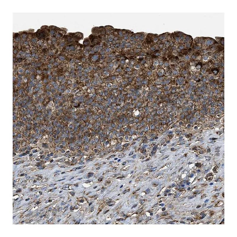 Atlas Antibodies Anti-SLC10A3 Antibody