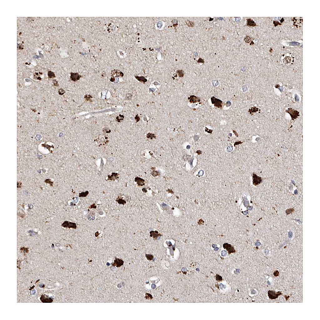 Atlas Antibodies Anti-SLC10A4 Antibody