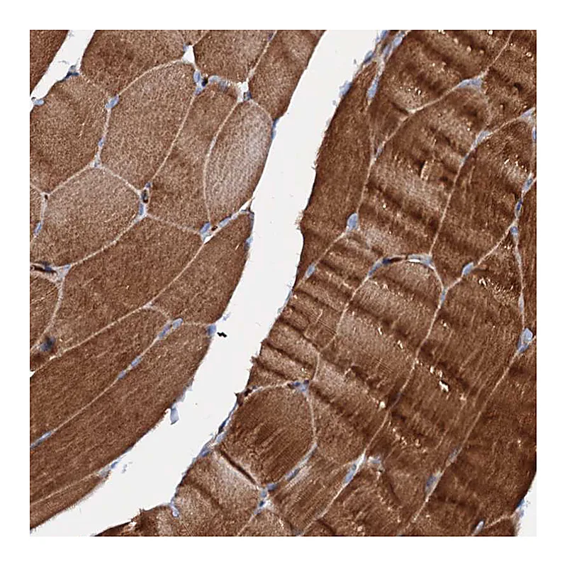 Atlas Antibodies Anti-SLC10A7 Antibody