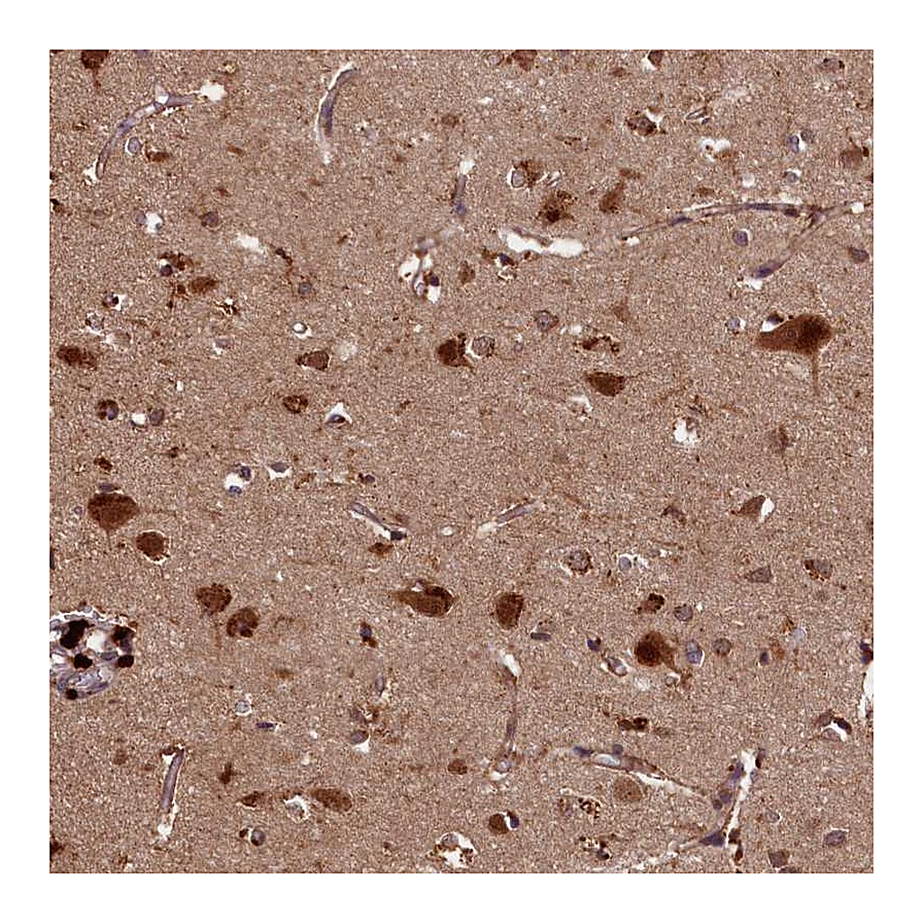 Atlas Antibodies Anti-SLC11A2 Antibody