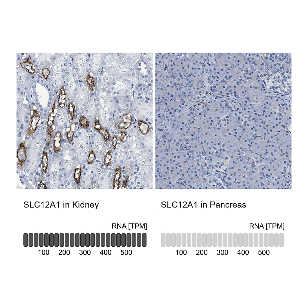 Atlas Antibodies Anti-SLC12A1 Antibody
