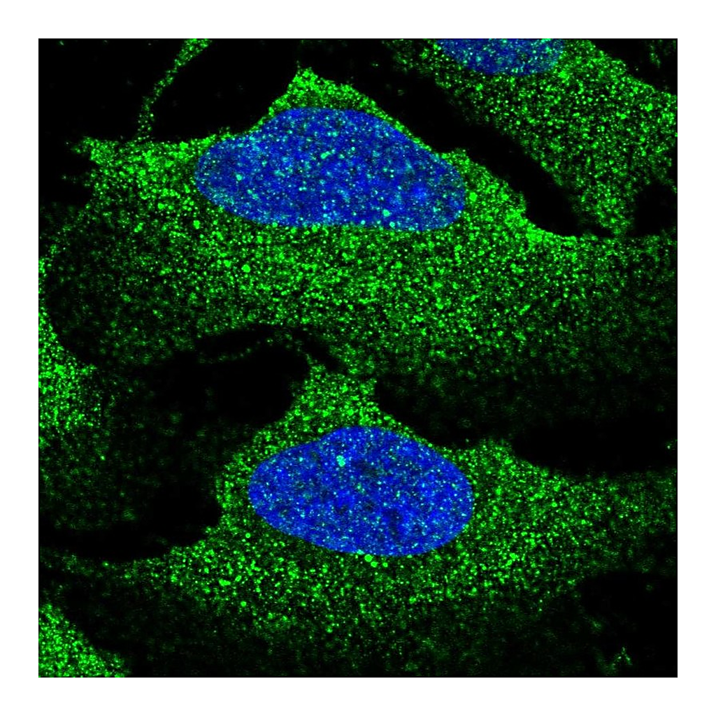 Atlas Antibodies Anti-SLC12A2 Antibody