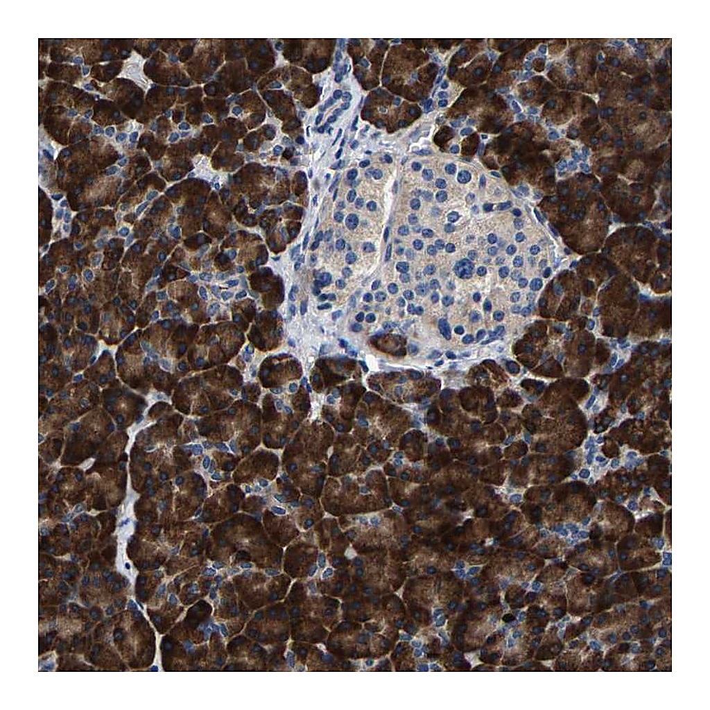 Atlas Antibodies Anti-SLC12A2 Antibody